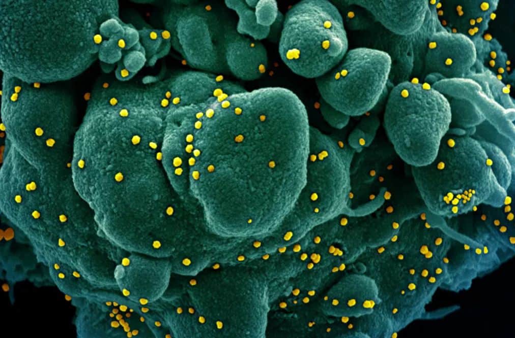 Scientists reveal how long antibodies to coronavirus last