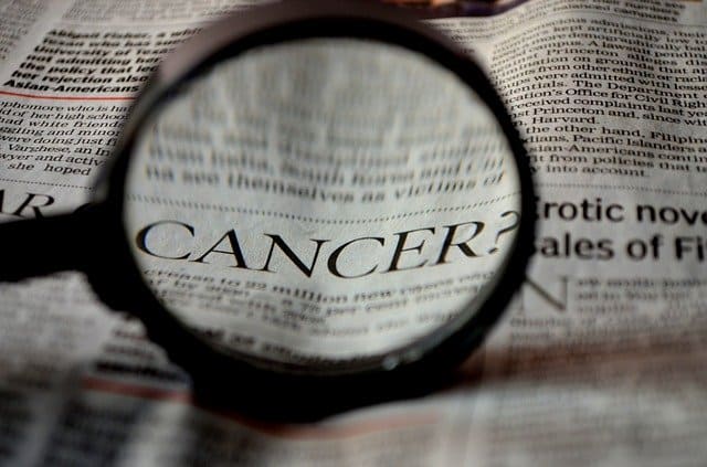 They find a simple factor that increases the risk of dying from cancer more than 80%