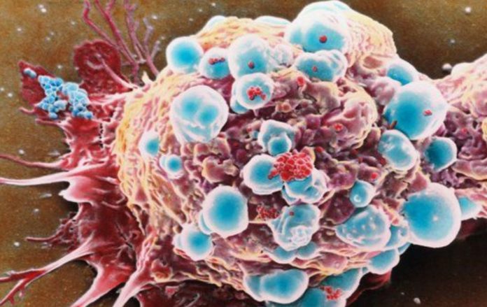 New cancer diagnostic method shows how patients will respond to immunotherapy