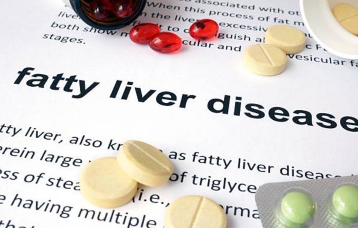 Fatty liver disease causes and non-alcoholic symptoms that may go unnoticed