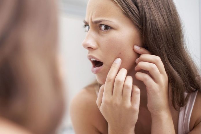 Acne Treatment: Is Roaccutane worth the side effects? And who shouldn't take it?