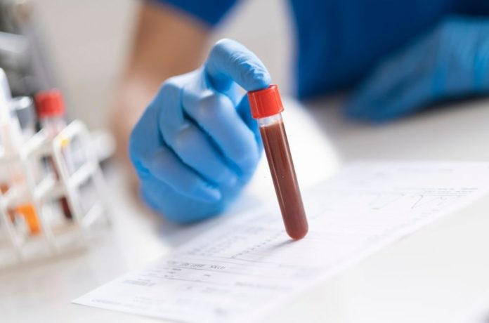 A simple blood test can detect up to 50 variants of Cancer before symptoms appear