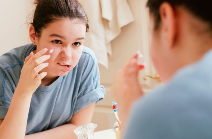 Skin diseases: Study finds 29 new genetic markers that are more common in people with acne