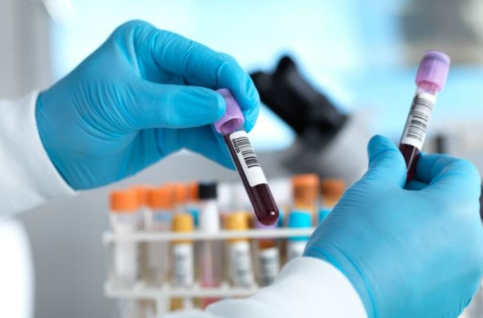 This simple blood test can predict if heart-attack patient dying in next 3 years