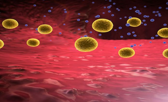 Fat-dissolving bile acids may help counter gut inflammation