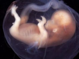Doctors Shocked After Finding Growing Fetus Inside a 40-day-old infant