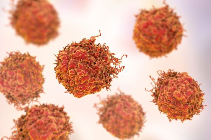 Scientists identify the most aggressive cancer cells with new tool
