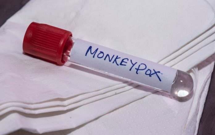 Monkeypox Symptoms Have Changed A Lot: These Are New Signs - Study