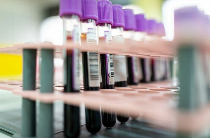 New Blood Test Gives Medics An Early Warning About 50 Types Of Cancer And Its Origin In The Body