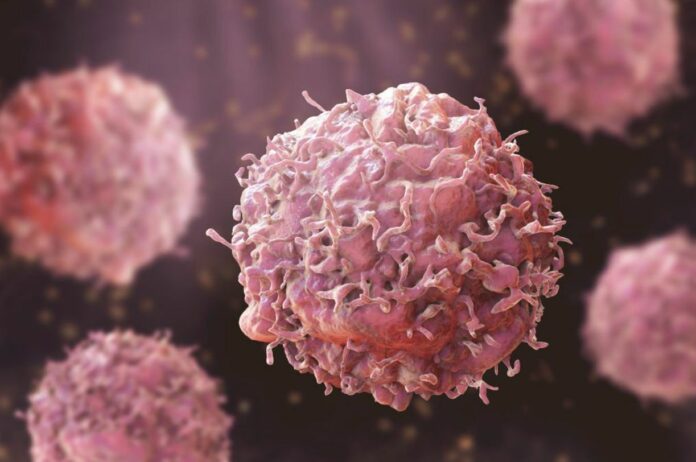 Scientists Found An Immune Cell Helps Kill Bladder Cancer Cells