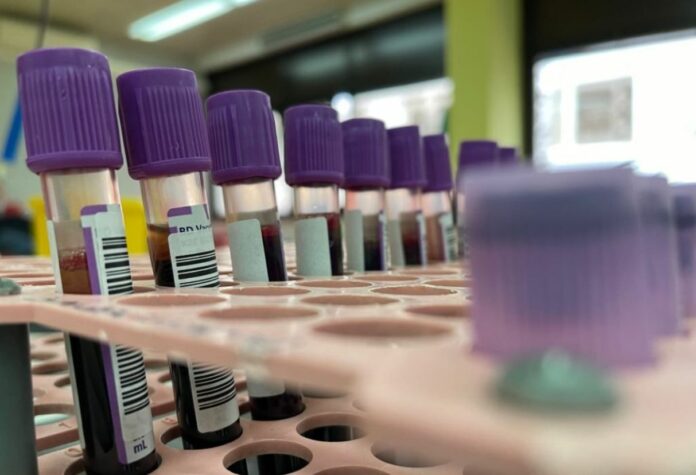 New Blood Test Can Detect 'Not Just Alzheimer’s, But Also Parkinson’s, Type 2 Diabetes And More' In Their Earliest Stages