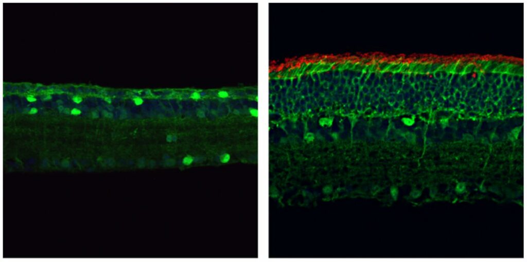 Los investigadores utilizan la nueva edición del genoma basada en CRISPR para restaurar la visión en ratones con retinosis pigmentaria
