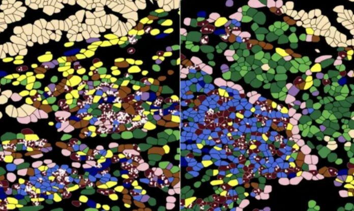 This New TCellMap is Revealing an Intricate Biology of Cancer We've Never Seen Before