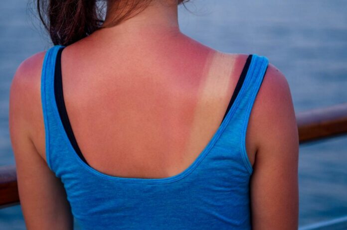 Sun Exposure: Do These Common Protection Methods Actually Work?